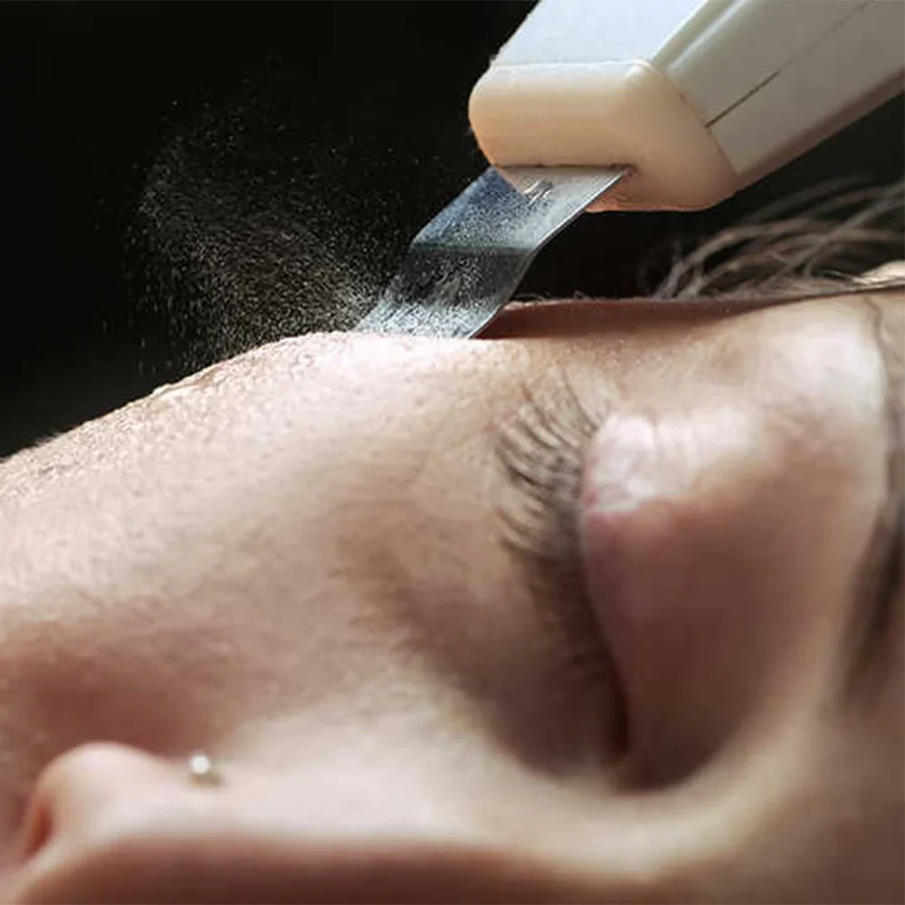 DermaGlow 5 - Ultrasons Peeling Visage - Image 7