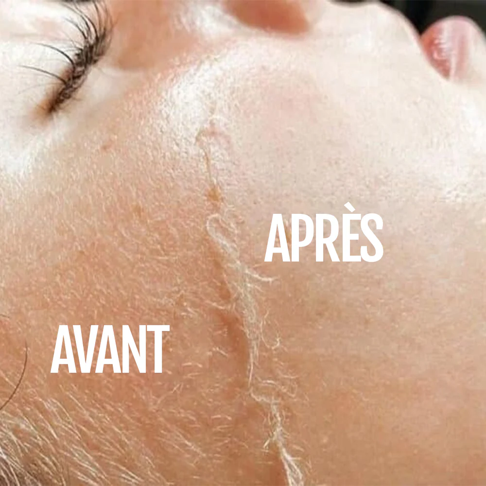 SILKYFLASH+ Dermaplaning Sonique Visage - Image 5