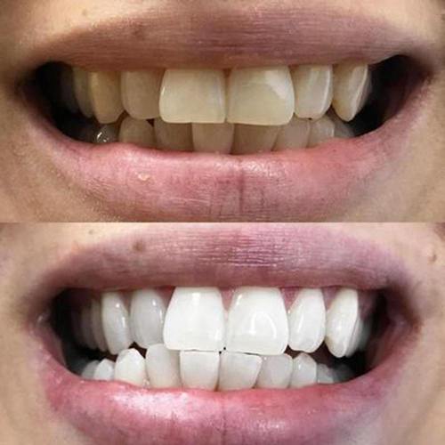 PAP+ Dentifrice - Image 9
