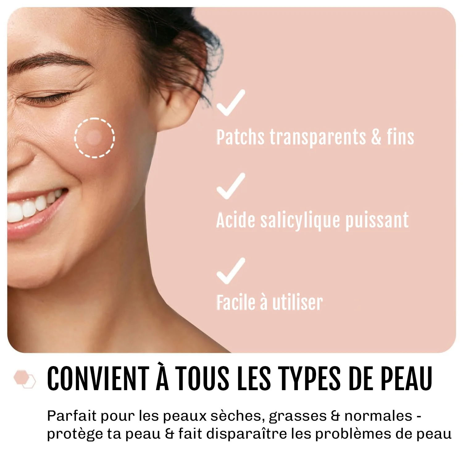 Patchs anti-boutons invisibles - Image 6